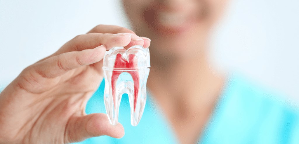 Root Canal Burnaby
